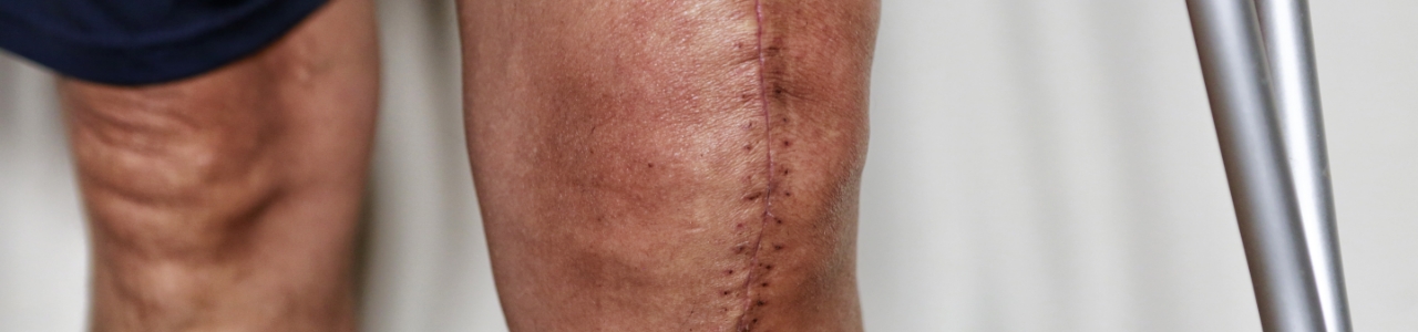 physical-therapy-clinic-pre-post-operative-rehabilitation-roadside-physical-therapy-elmhurst-brooklyn-woodside-great-neck-ny